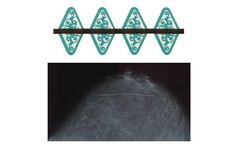 Spee-D-Line - Model SDW-SSD3 - 3D Digital Breast Tomosynthesis Mammography Scar Marker