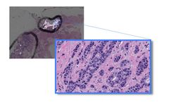 Paige - Novel Predictive and Prognostic Tissue-Based Biomarkers Software