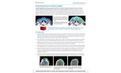 Adaptiiv - Modulated Electron Bolus Software - Brochure