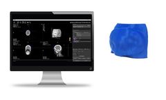 Adaptiiv - Modulated Electron Bolus Software