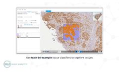 HALO Image Analysis - Video