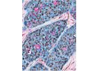 Multiplex - Version IHC - Cell-Based Analysis Module