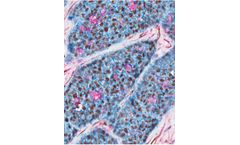 Multiplex - Version IHC - Cell-Based Analysis Module