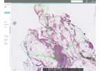 Halo - Version AP - Anatomic Pathology Workflow Software