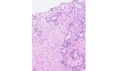 Halo Prostate - Version AI - AI-Powered Diagnostic Software