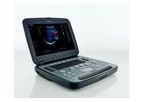 Siemens - Model Acuson P500 - Ultrasound System