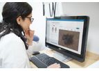 DermTriage - Makes Teledermatology Practical