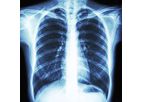 Cardiothoracic Imaging Services