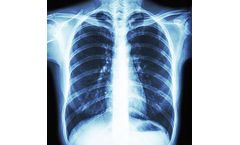 Cardiothoracic Imaging Services