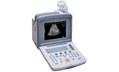 Welld - Model WED-9618 - B-Ultrasound Diagnostic Apparatus