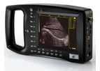 Welld - Model WED-3100 - Palm-Size Full-Digital Ultrasound Diagnostic System