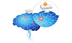 ni2o - Model KIWI - Kinetic Intelligent Wireless Implant