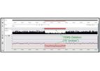 BioDiscovery - Whole Genome Sequencing Tools