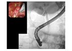 Diagnostic ERCP Software of Image Analysis and AI