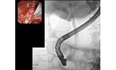 Diagnostic ERCP Software of Image Analysis and AI