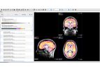 VivoQuant - Image Analysis and Quantitative Analytic Software