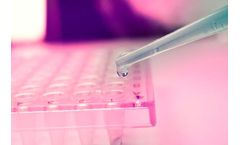 Cartherics - Autologous T cells
