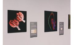 Digital Microscopic Imaging and Morphometric Analysis