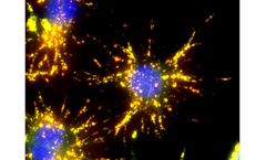 AAT Bioquest - Quantifying Cytosolic Calcium