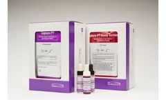 Platelet Antibody Screening