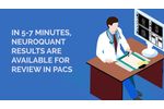 NeuroQuant is easy to incorporate into your radiology workflow. - Video