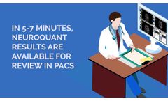 NeuroQuant is easy to incorporate into your radiology workflow. - Video