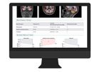 NeuroQuant - Version MSA - Multi-Structure Atrophy Report Software