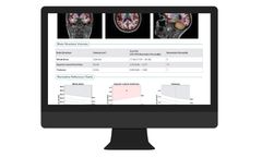 NeuroQuant - Version MSA - Multi-Structure Atrophy Report Software
