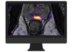 OnQ Prostate - Breakthrough Software Supporting Improved Prostate Cancer Detection