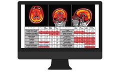 PETQuant - Fast & Automated Subregional Tracer Quantification Software