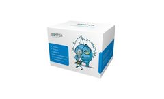 Model DZ41380 - Anti-African Malaria Mosquito REL2 Antibody