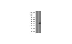 Model KIR3DP1 (NM_001015070) - Human Over-Expression Lysate