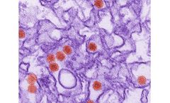 InBios - Model NuGen™ ZIKV IgG - Capture ELISA Kit