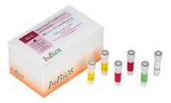 Smart Detect - Model SARS-CoV-2 rRT-PCR - Real-time RT-PCR Test Kit