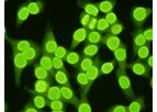 Scimedx - Anti-nuclear Antibody (HEp2 Cell Culture) Test Kit
