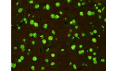 Scimedx - Anti-nuclear Antibody Test Kit