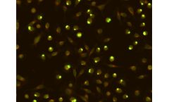 Scimedx - Chlamydia Trachomatis IgG Test Kit
