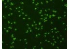 Scimedx - Toxoplasma Gondii IgG 120 Test Kit