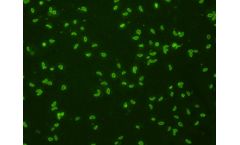 Scimedx - Toxoplasma Gondii IgG 120 Test Kit