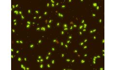 Scimedx - Toxoplasma Gondii IgM Test Kit
