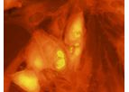 Scimedx - Cytomegalovirus IgG Test Kit
