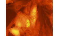 Scimedx - Cytomegalovirus IgG Test Kit