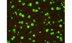MeDiCa - Model IIF - Anti-Nuclear Antibody (ANA) Test Kit