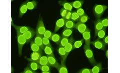 MeDiCa - Model ANA HEp2 IIF - Anti-Nuclear Antibody (ANA) Test Kit