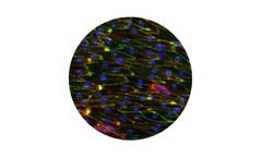 Ncardia - Human iPSC-Derived Vascular Endothelial Cells