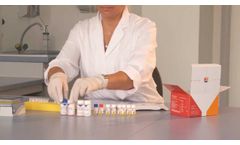 ELISA Test Systems in Autoimmune Disease Diagnostics (Autoimmunity) - Video