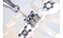 SternaLock - Model EZ - Next Generation Closure System
