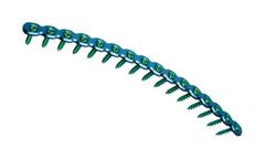 RibFix Blu - Thoracic Fixation System