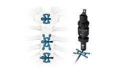 SternaLock - Model 360 - Sternal Closure System