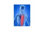 Meagan - Model DISCSS - Dynamic Interferential Spinal Cord Stimulation System